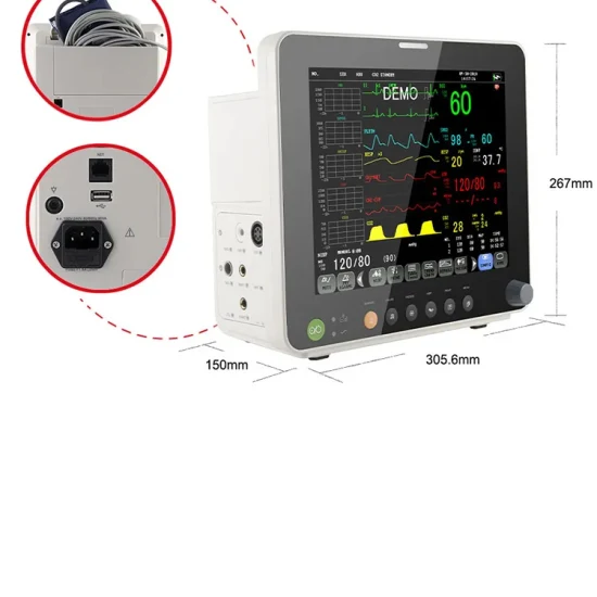 pictorial view of a multi-parameter patient monitor.