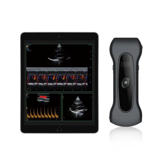 Aura Serie PAU2A wireless Handheld Color ultrasound system with high-frequency probe and Color Doppler imaging